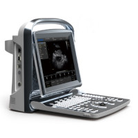 Chison ECO1 Ultrasound 