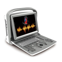 Chison ECO6 Colour Doppler Ultrasound 