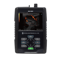 Honda HS-103V Bovine Colour Doppler Ultrasound