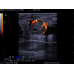 Honda HS-1600 Colour Doppler Ultrasound